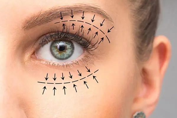 Oculoplasty Evaluation